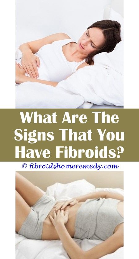 Pin on Icd 10 Uterine Fibroids