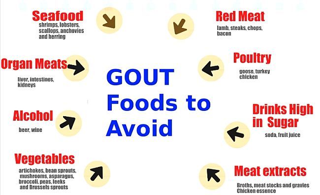 Pin on gout remedies