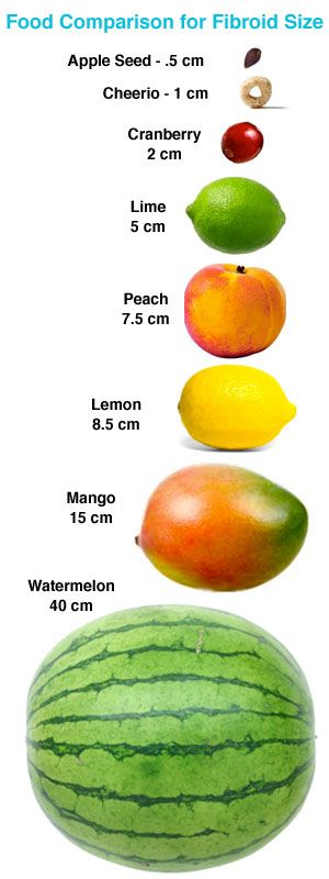 Fibroid Size Chart In Mm