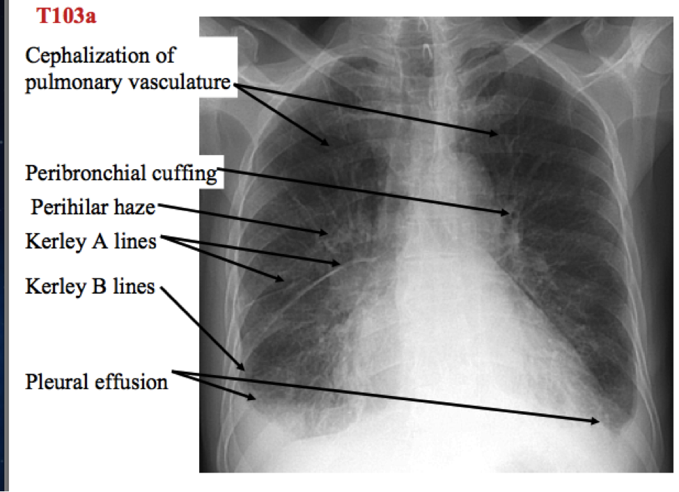 Radiografia