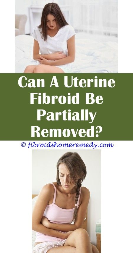 Pin on Icd 10 Code For Uterine Fibroids