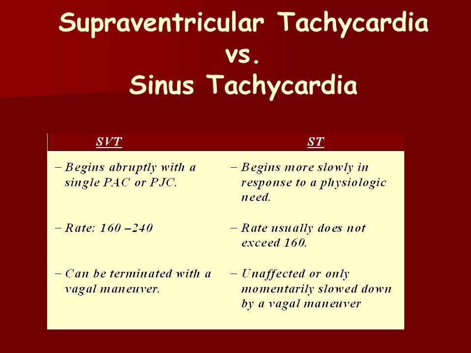 Difference Between Svt And Afib