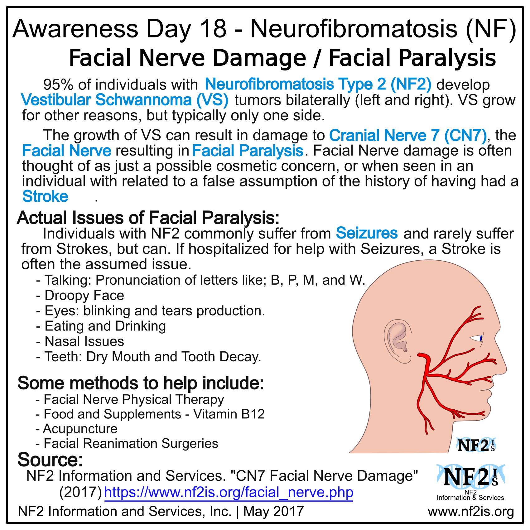 6th Cranial Nerve Palsy