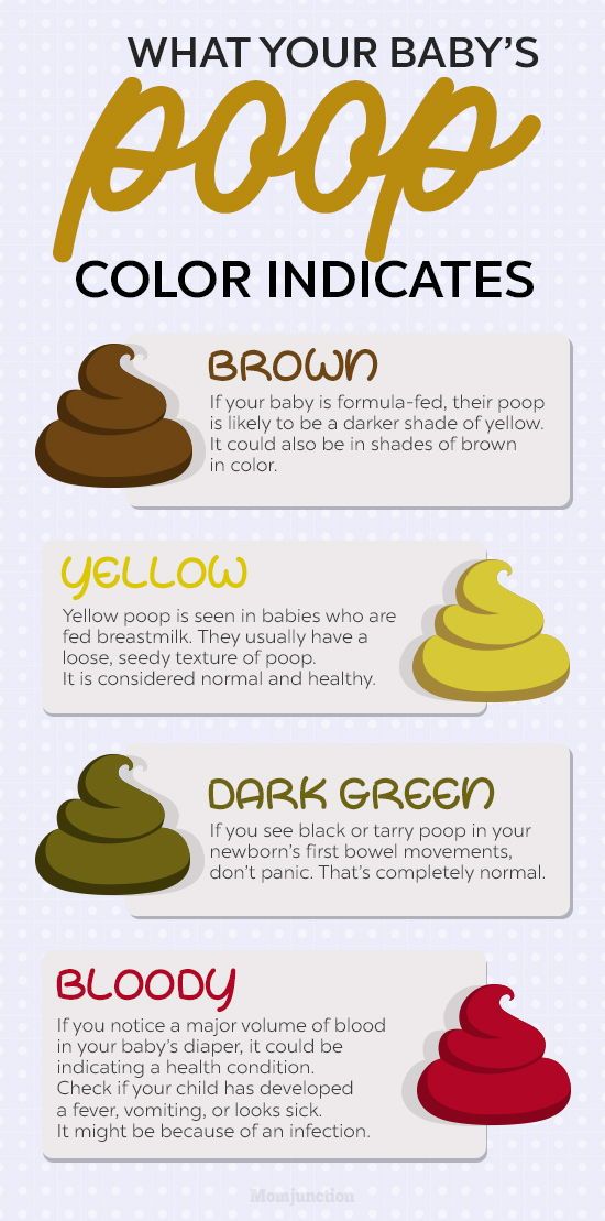 How to decode warning signs from your baby’s poop color – Artofit