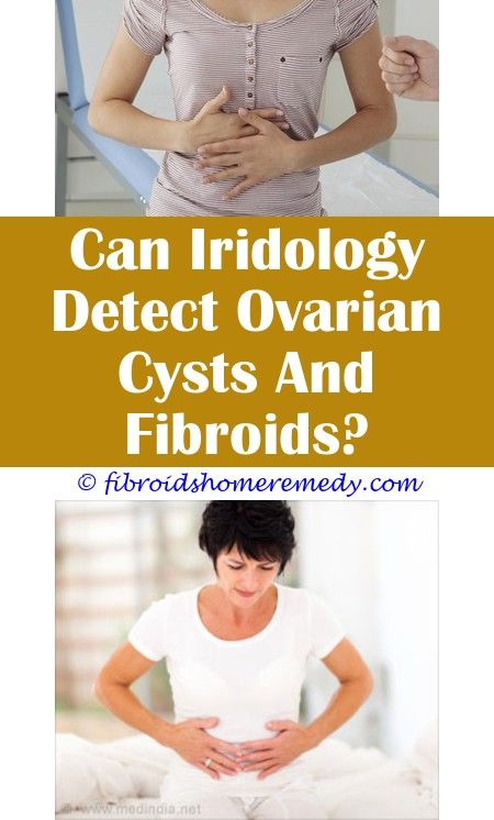 Breast Fibroids Symptoms And Treatment Youtube