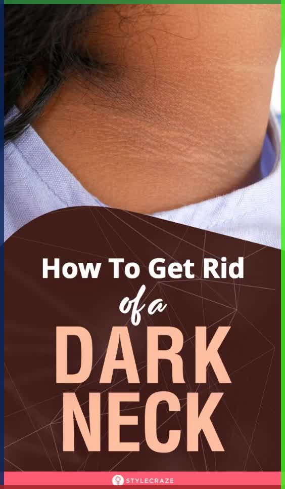 12 Effective Home Remedies To Get Rid Of A Dark Neck: We tend to ignore our neck while cleansing our face. Over time, dirt and pollutants accumulate and damage the skin around your neck. And, even if you do wash and scrub your neck, you might forget to moisturize. This results in dark patches, wrinkles, and other blemishes. The remedies given in this article can help to lighten the dark skin on your neck. #Remedies #HomeRemedies #NaturalRemedies #DarkNeck