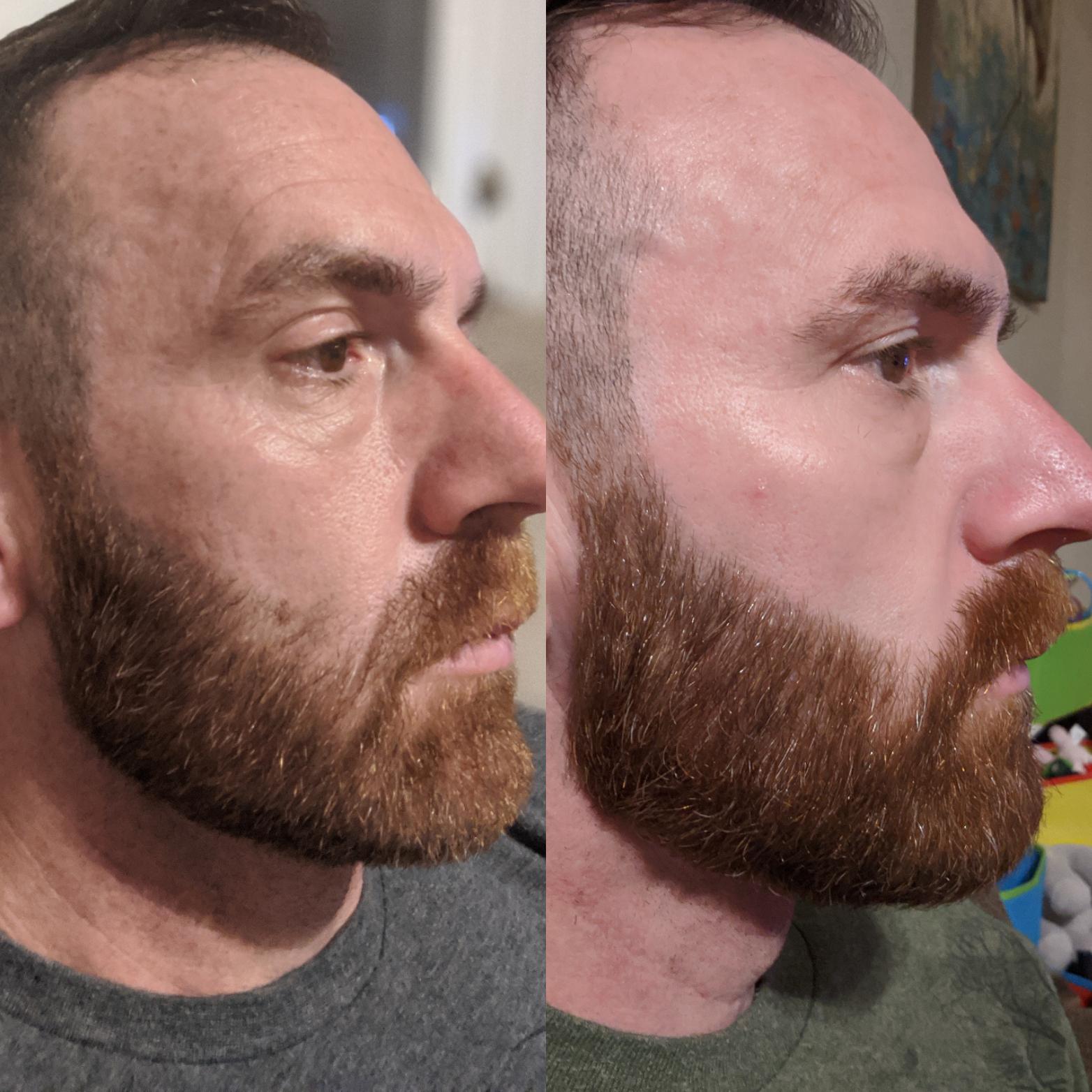 1 month progress from a bad beard trim : r/beards