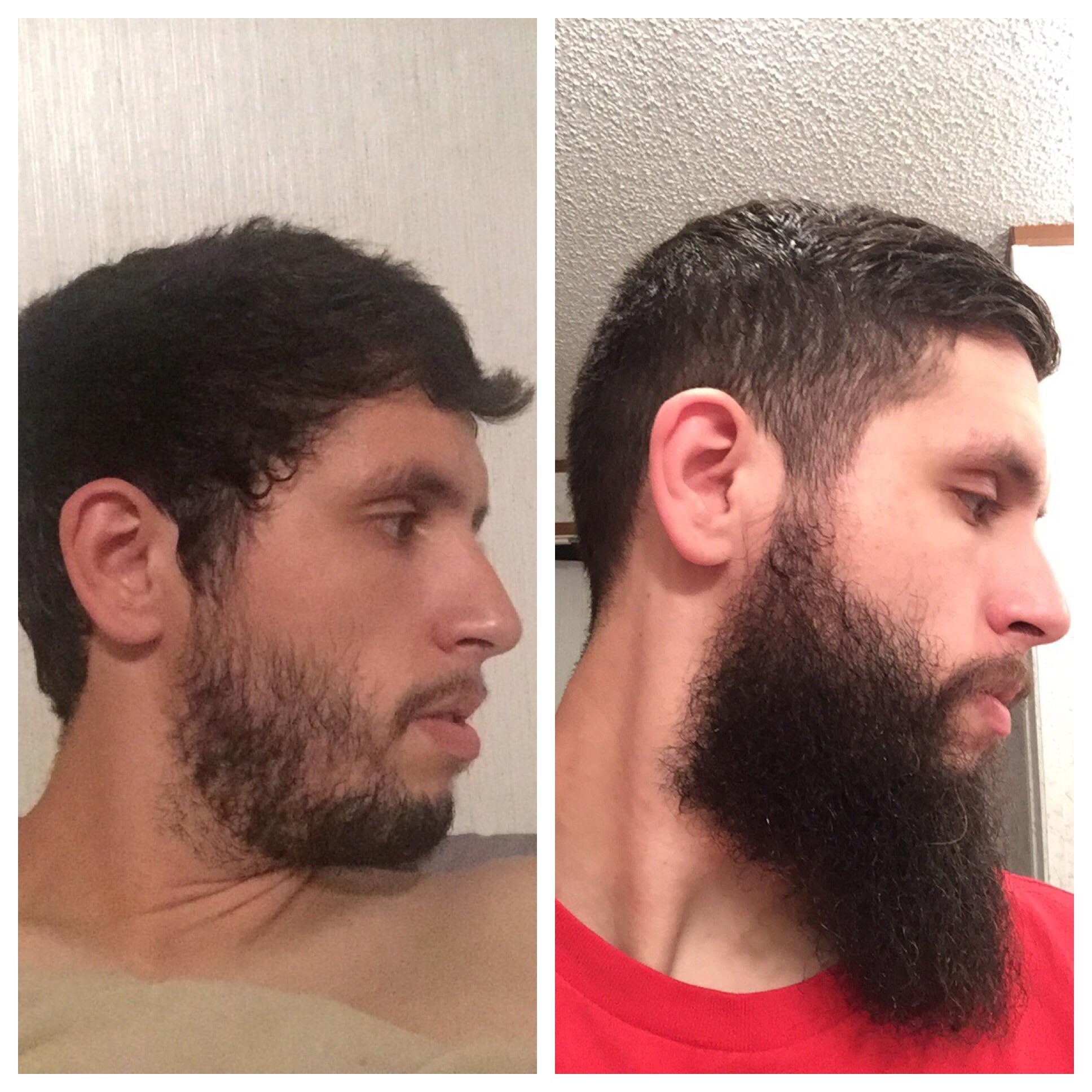 Beard Growth Stages