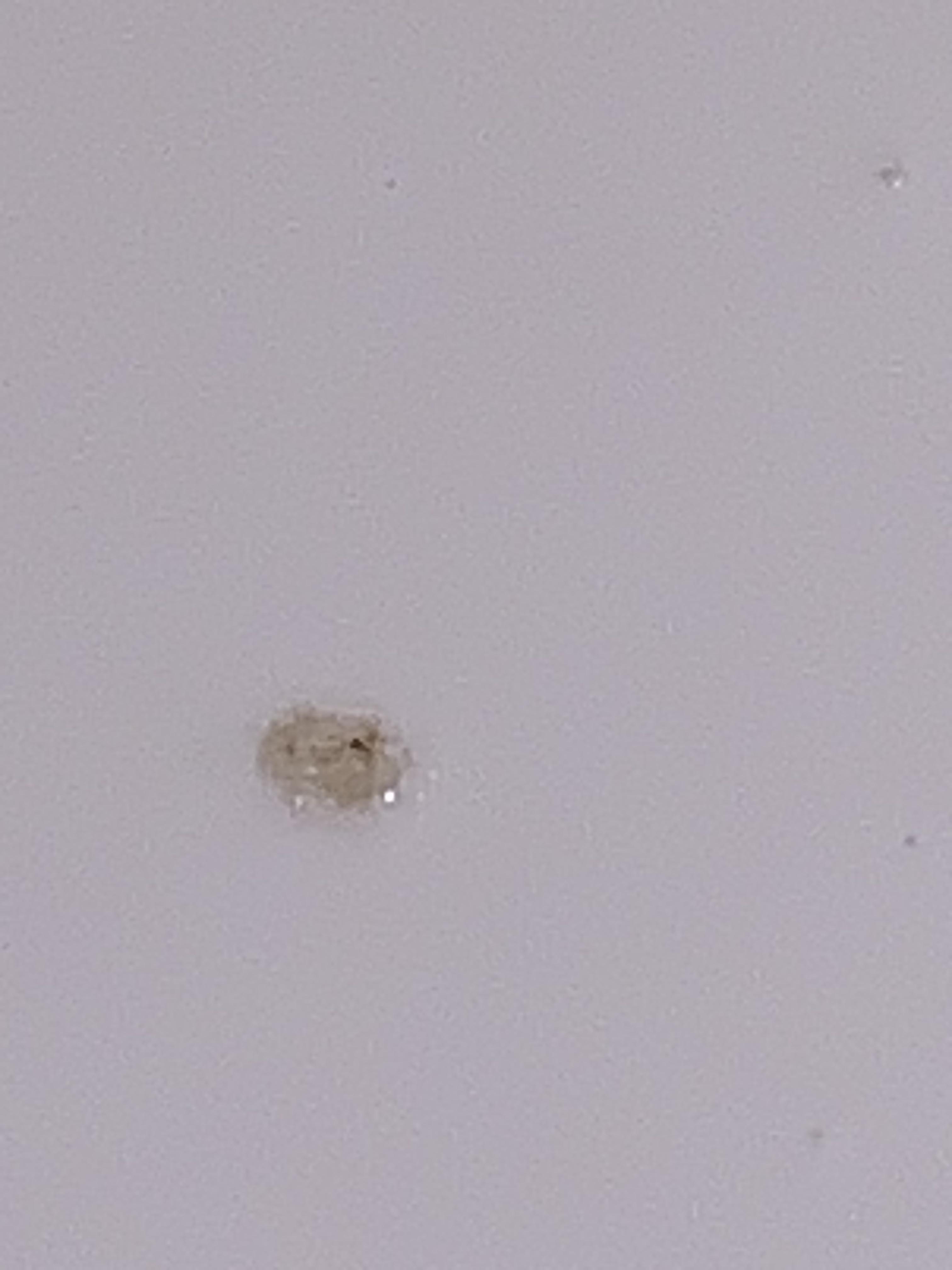 Is this scabies : r/scabies