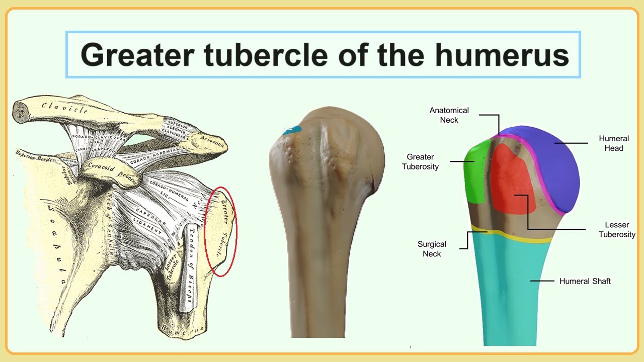 greater tubercle of the humerus - YouTube