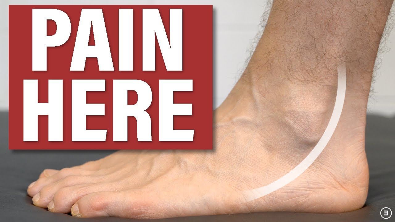 Peroneal Tendinopathy / Tendinitis: Causes & Treatment (Education ...