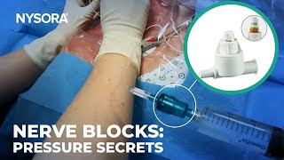 Safer Nerve Blocks: Why Injection Pressure Matters