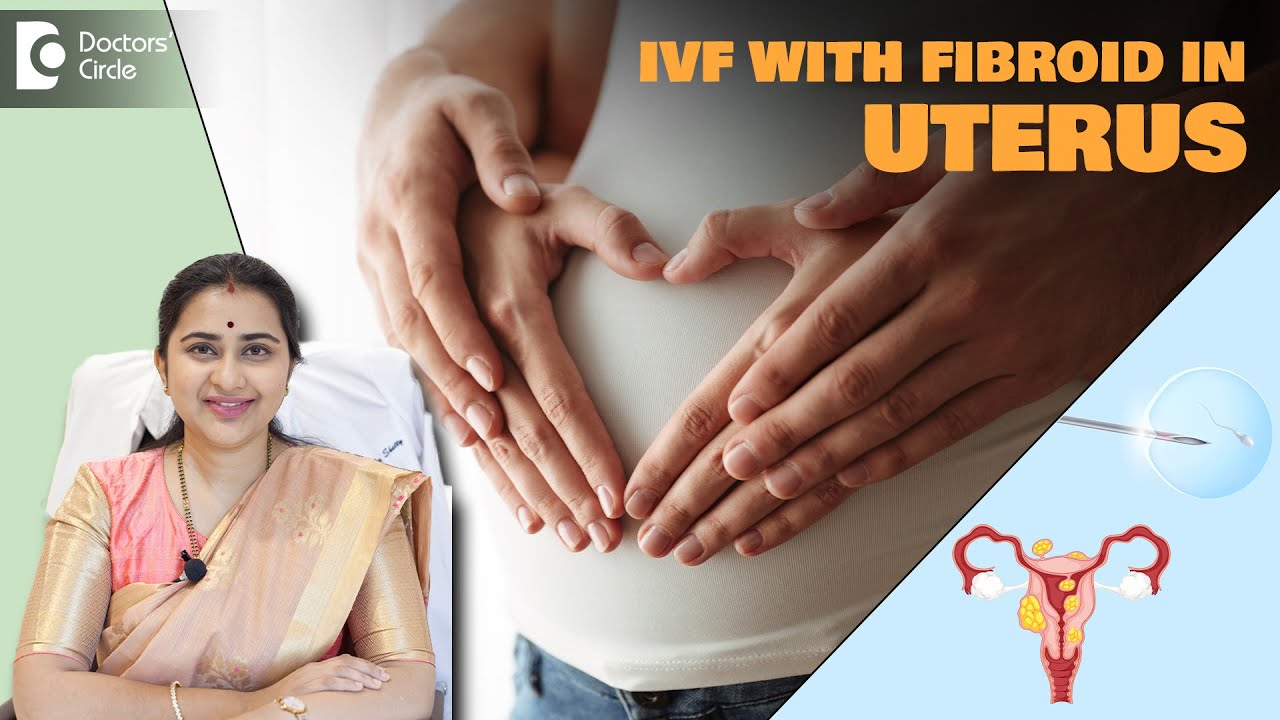 IVF PREGNANCY with FIBROID |Can Fibroids affect Embryo Implantation?-Dr ...