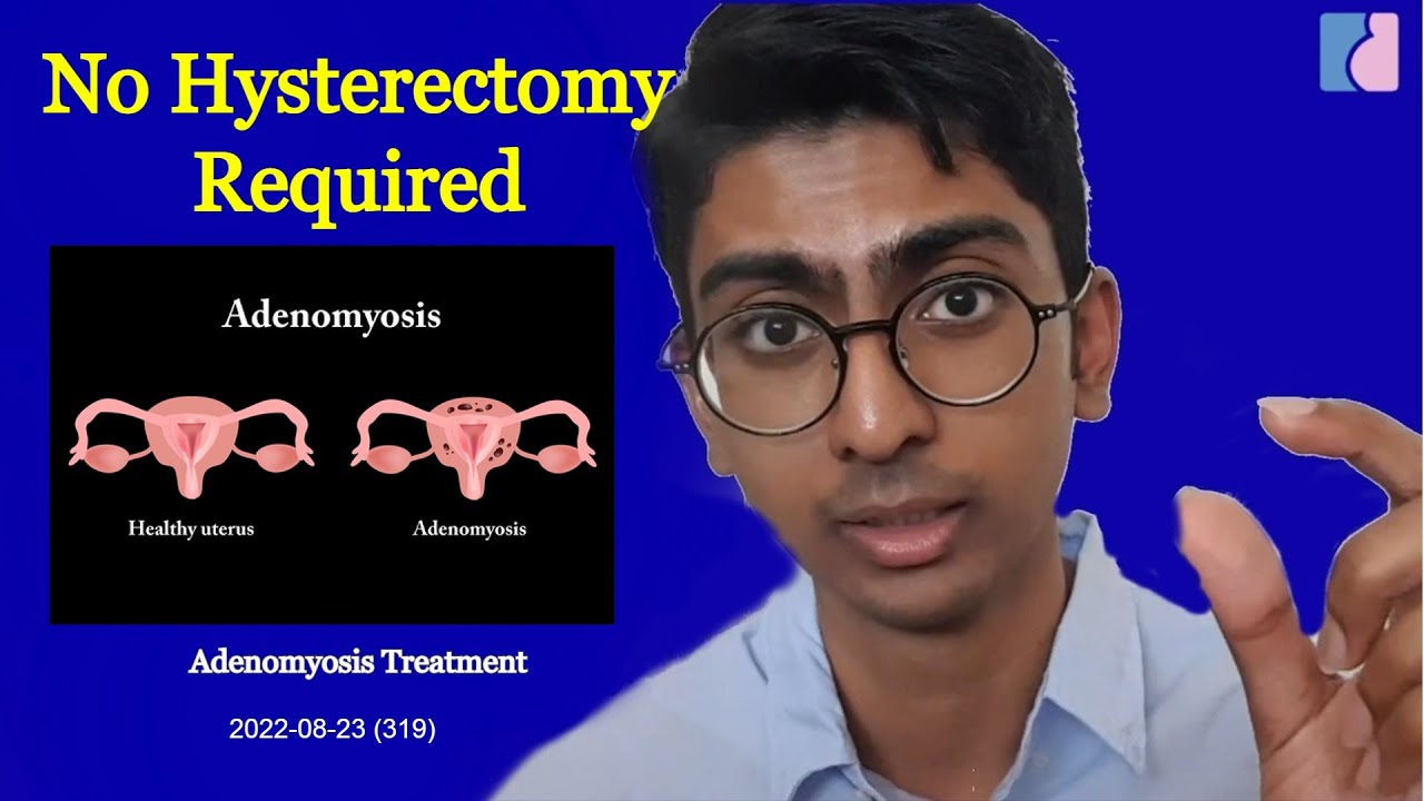 Adenomyosis Treatment: No Hysterectomy Needed! - Antai Hospitals - YouTube