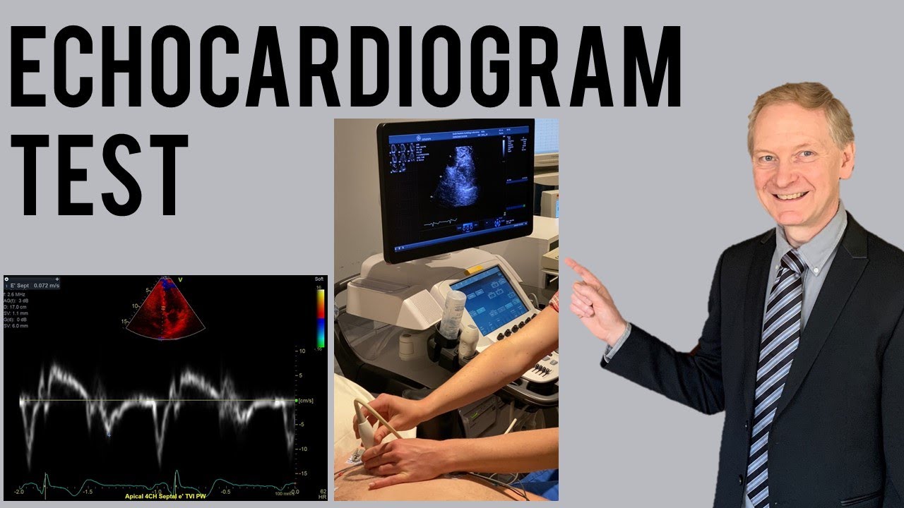 Echocardiogram Procedure | Heart Ultrasound | Everything you need to ...