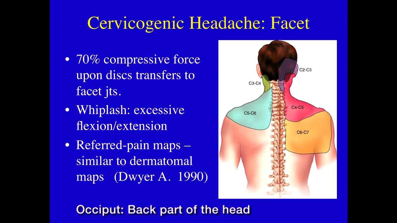 Greater Occipital Headache