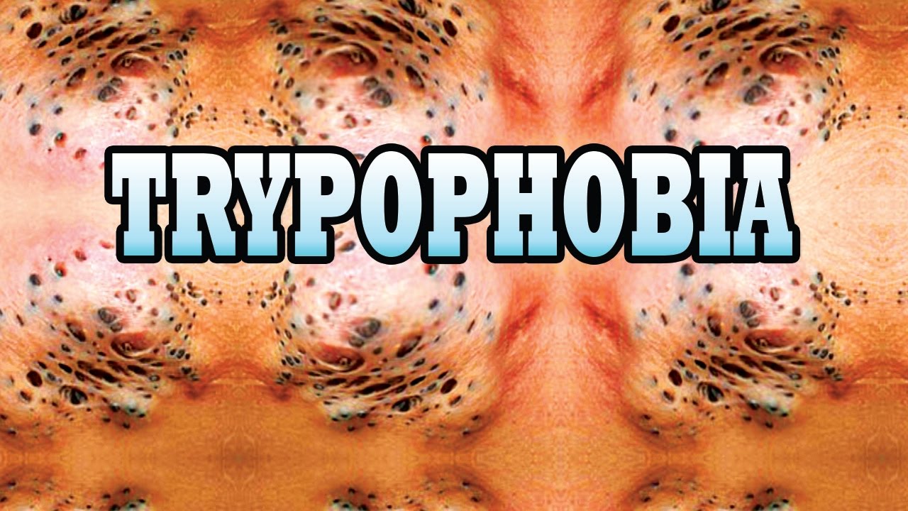 Where Do I Learn about Trypophobia? Visit Trypophobia911.com - YouTube