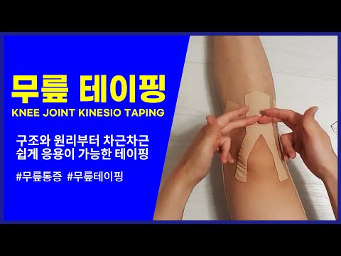 무릎 테이핑 :: 원리만 알면 응용가능 (knee joint taping)