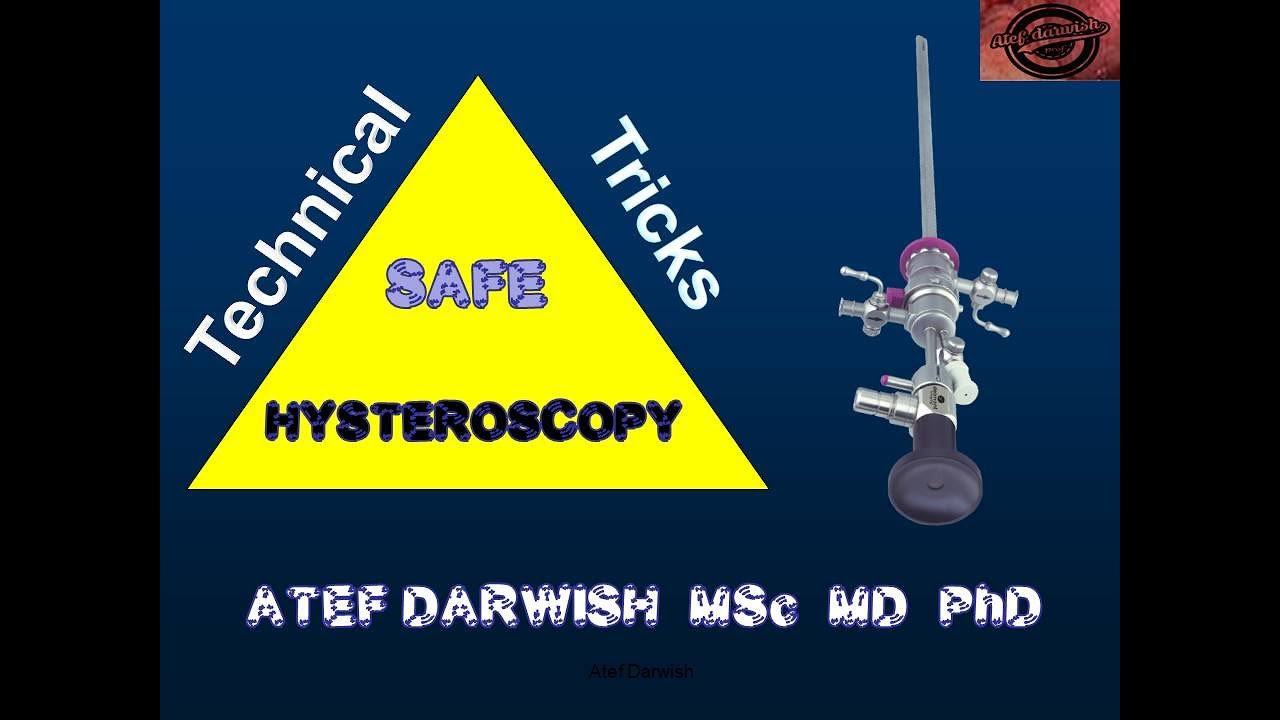 Practical tricks for safe hysteroscopic surgery. - YouTube