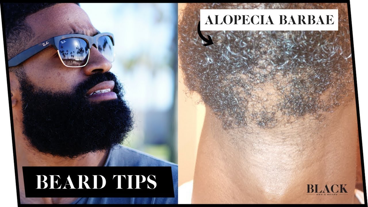 Alopecia Barbae Causes