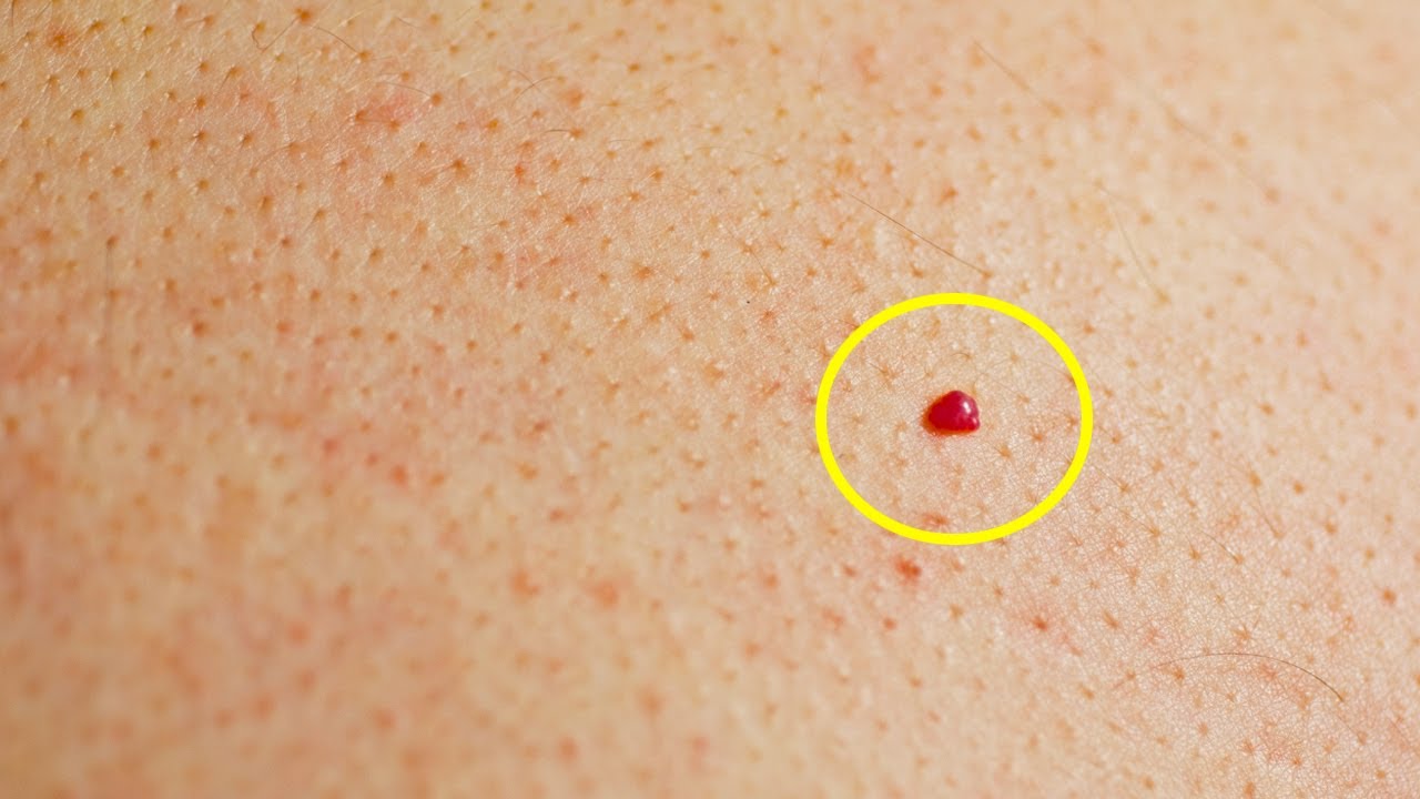 What Causes Red Spots On Skin