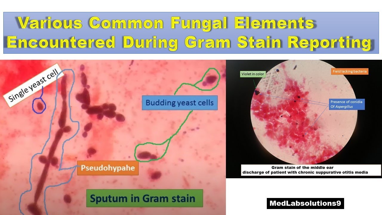 Aspergillus Conidiophores Gram Stain