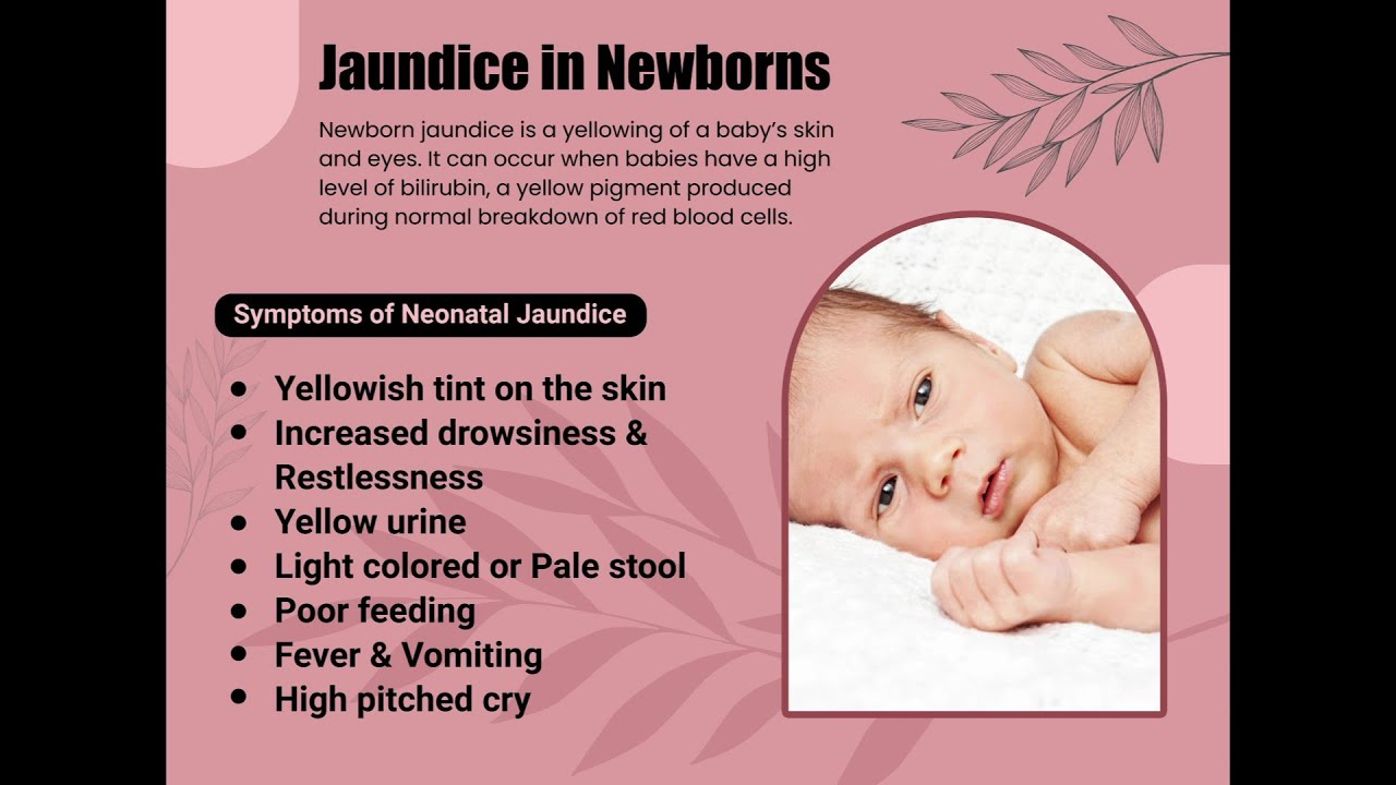 Infant Jaundice Eyes