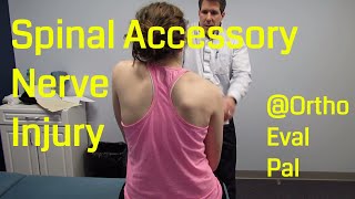 Spinal Accessory Nerve Injury Video | Doovi