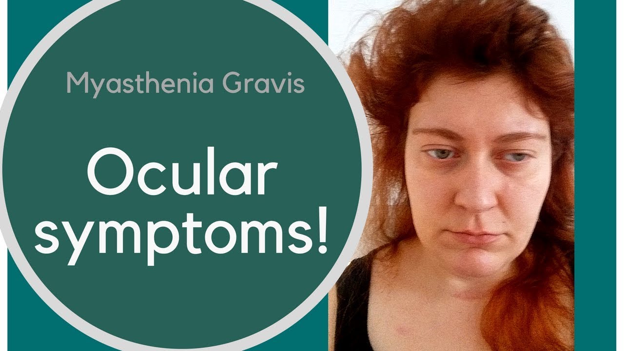 Ocular Myasthenia Gravis Symptoms