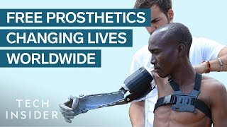 Meet The 24-Year-Old Whose Prosthetic Limbs Are Changing Lives