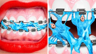 ME VS BRACES - Crazy BEAUTY Teen Struggles| Funny AWKWARD Relatable Situations by 123GO! CHALLENGE