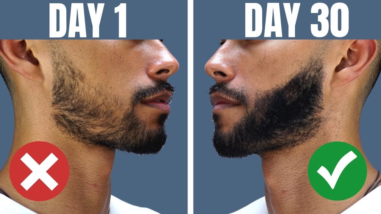 How To Grow Beard On Cheeks | atelier-yuwa.ciao.jp