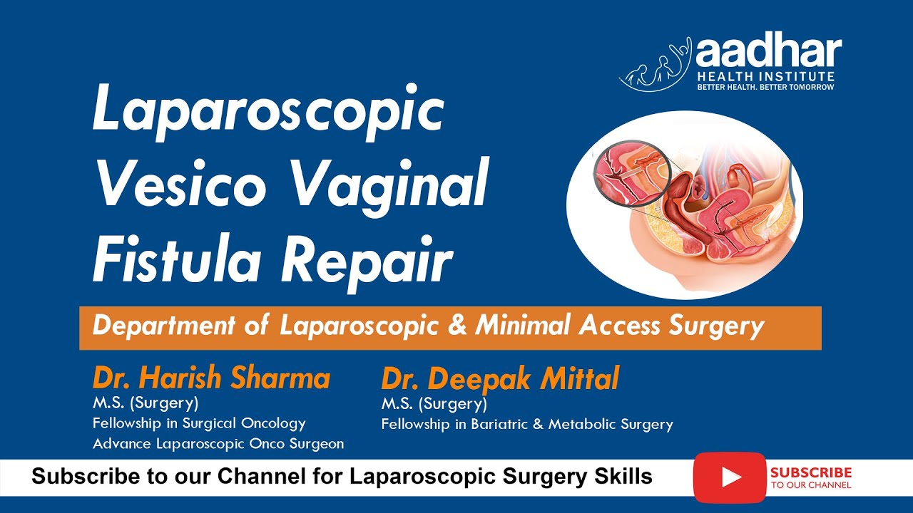 Laparoscopic Surgical repairs of vesicovaginal fistulas (VVF) - YouTube