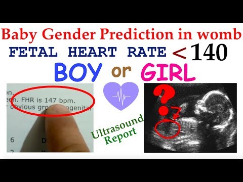 Baby Heartbeat At 11 Weeks Boy Or Girl – Baby tickers