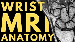 Wrist MRI Anatomy | Radiology anatomy part 1 prep | How... | Doovi