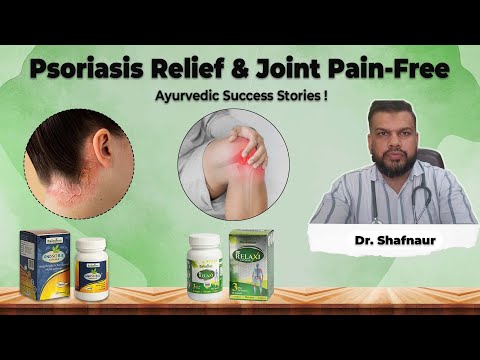 Psoriasis Relief & Pain-Free? Dr. Reviews Rajasthan Aushadhalaya Products