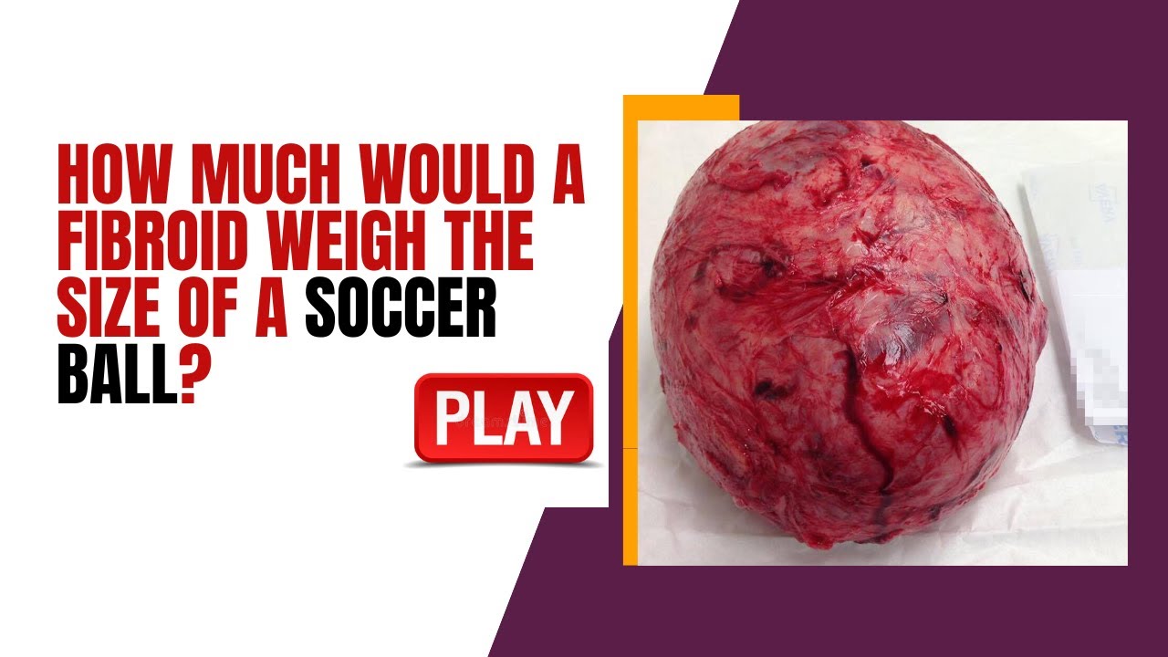 How Much Would a Fibroid Weigh the Size of a Soccer Ball? - YouTube