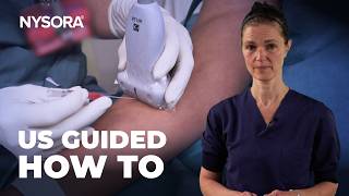 GUIDE TO ULTRASOUND-GUIDED IV ACCESS