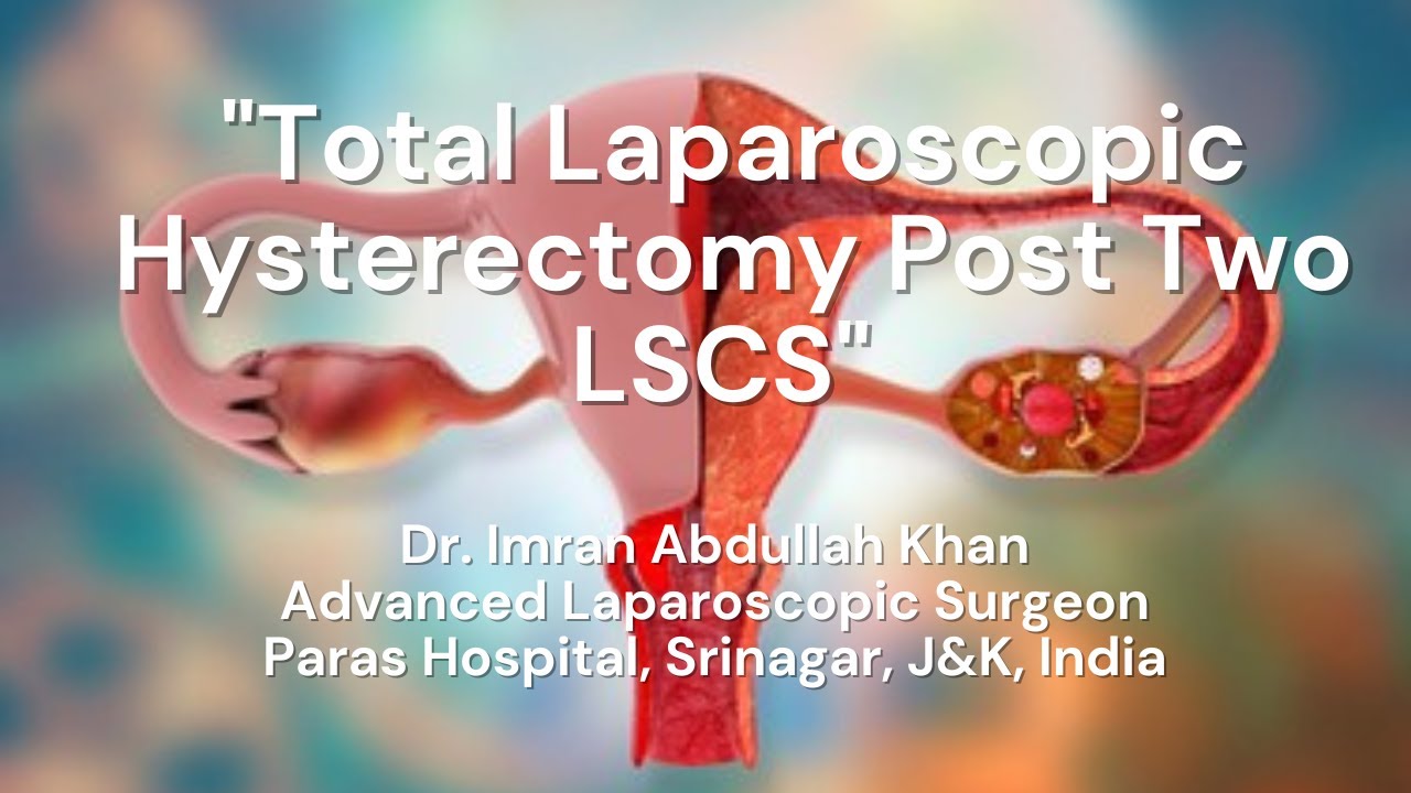 TLH Post Two LSCS | Total Laparoscopic Hysterectomy | Dr. Imran ...