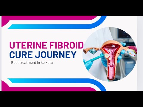 How to get cured from uterine Fibroid. - YouTube image.