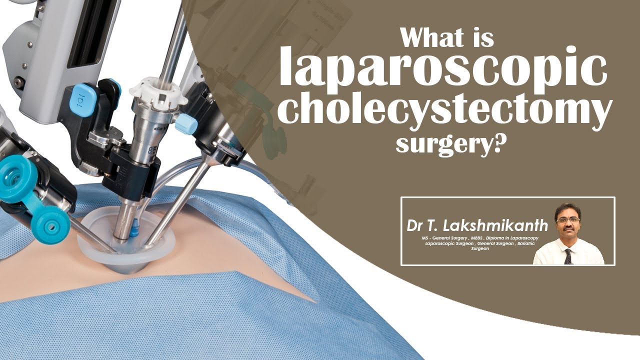 what is laparoscopic cholecystectomy surgery? | Gallbladder Removal ...