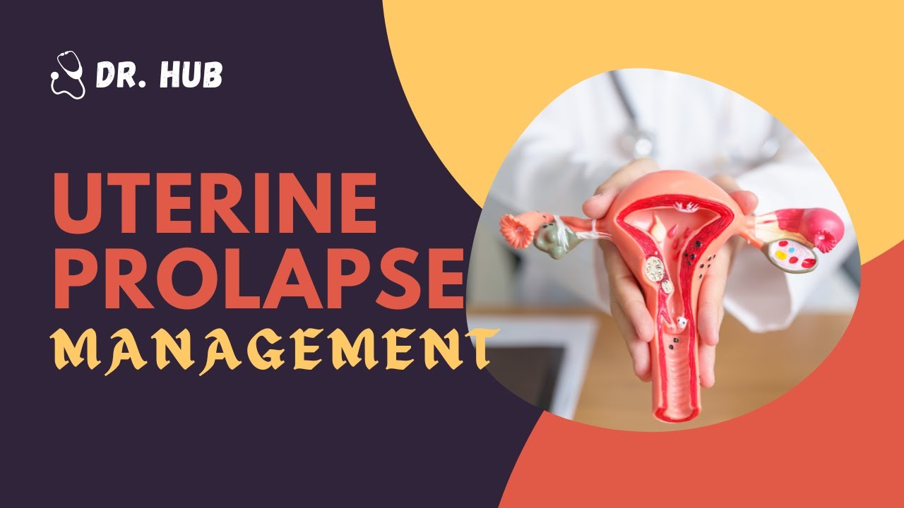 Uterine Prolapse Management - YouTube