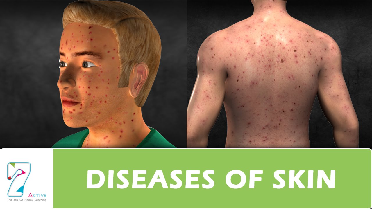 Human Skin Conditions And Diseases - vrogue.co