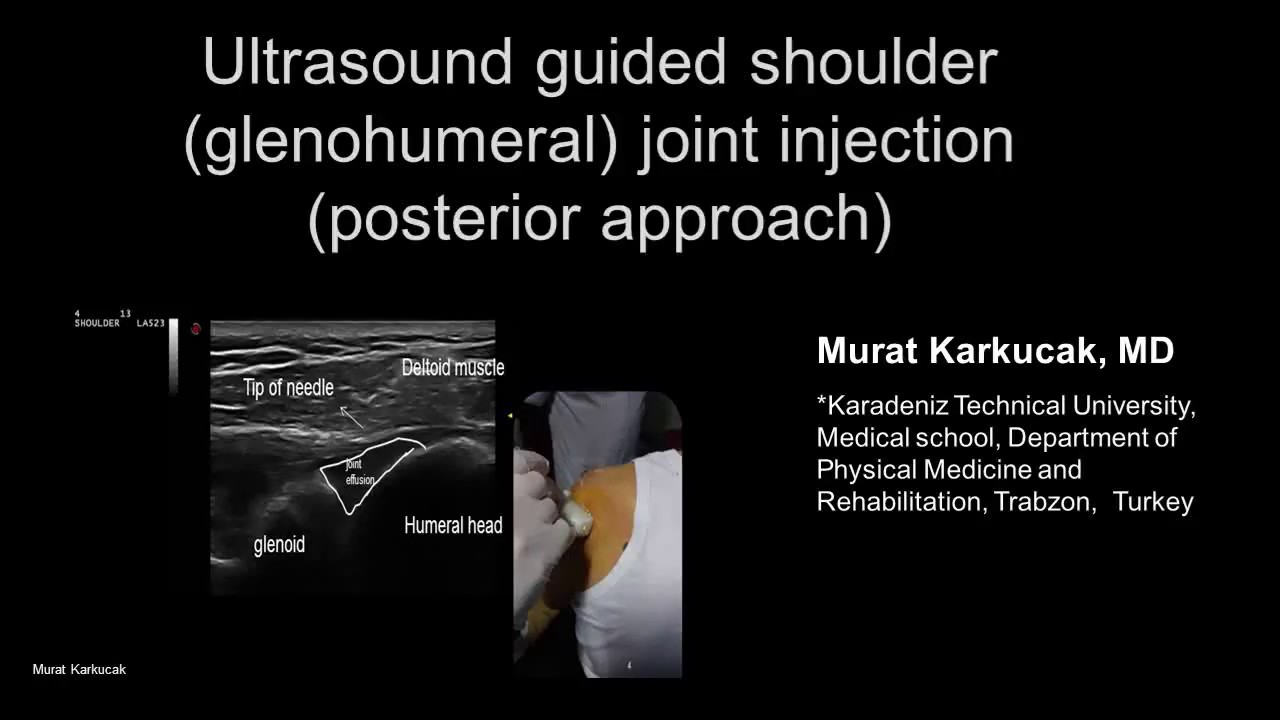 AC Joint Ultrasound