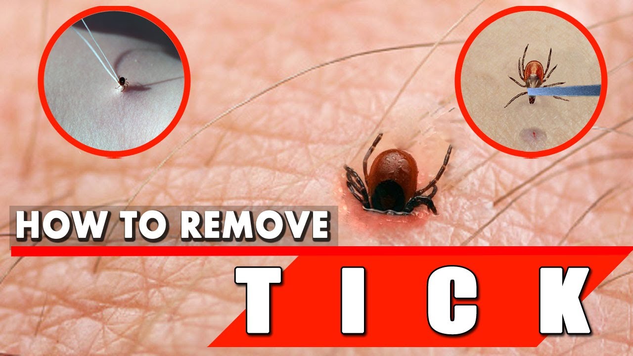 Embedded Tick Head Left