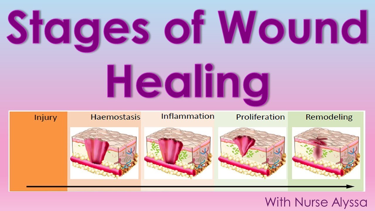 Wound Healing Steps