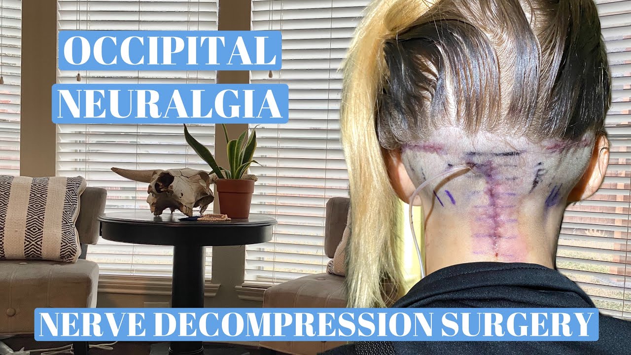 Occipital neuralgia Nerve decompression surgery recovery - YouTube