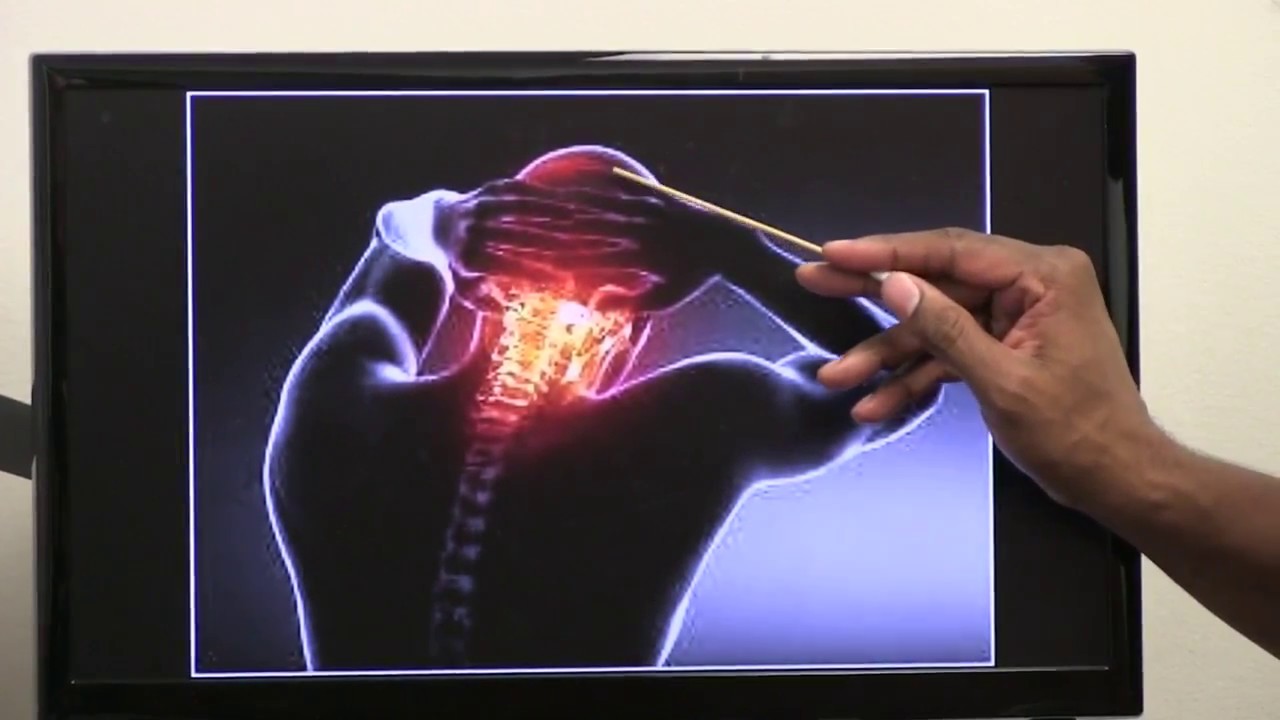 Occipital neuralgia : Symptoms & Treatments so EVERYBODY Understands ...