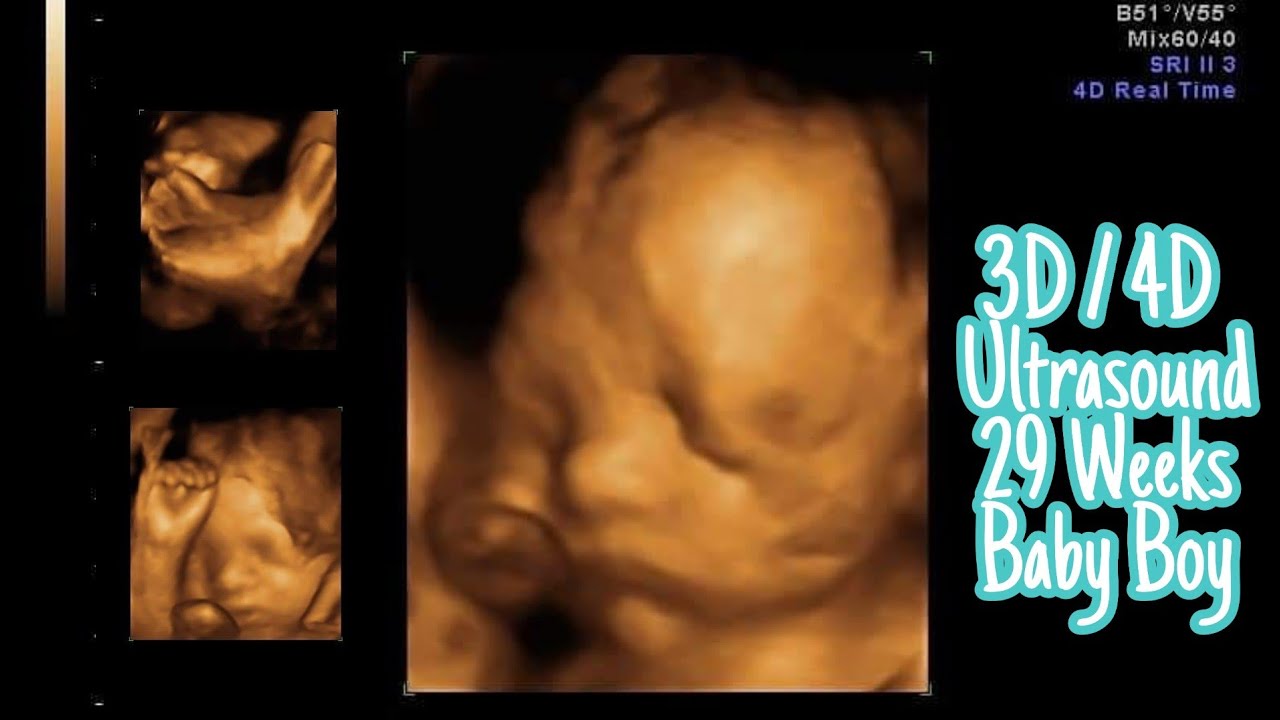 29 Weeks Ultrasound