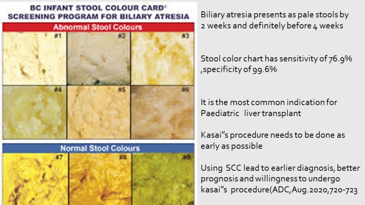 12 free printable stool color charts word pdf - medical stool color ...